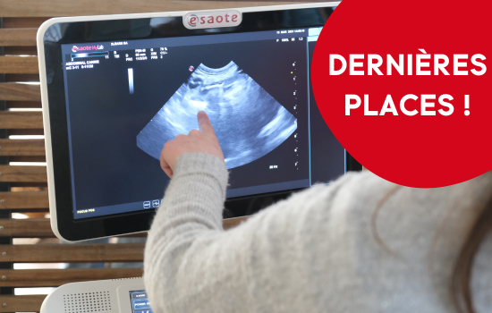 ID1096 - Perfectionnement en échographie abdominale - Edition 4